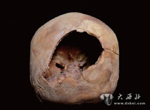 小河墓地频出科技考古新成果 3500 年前小河居民做开颅手术 小河墓地频出科技考古新成果 3500 年前小河居民做开颅手术