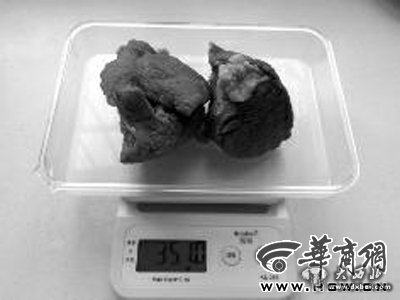 点击图片进入下一页 \