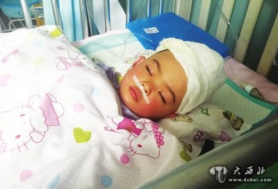祸从天降,螺丝刀从19楼坠下扎入两岁女童颅脑