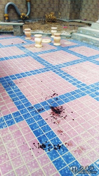 祸从天降,螺丝刀从19楼坠下扎入两岁女童颅脑